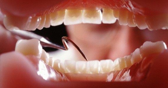 PERIODONTIA